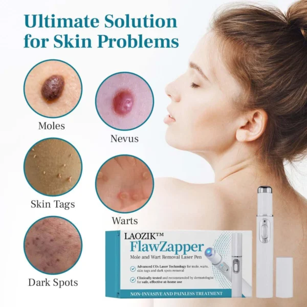 LAOZIK™ FlawZapper Mole and Wart Removal Laser Pen - Image 7