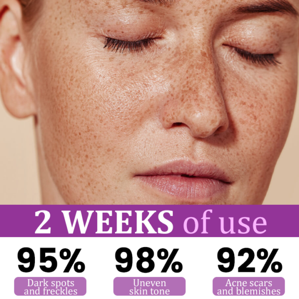 LAOZIK™ MelantraX Advanced Anti-Hyperpigmentation Essence - Image 5