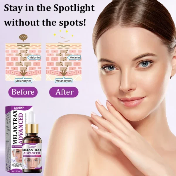 LAOZIK™ MelantraX Advanced Anti-Hyperpigmentation Essence - Image 2