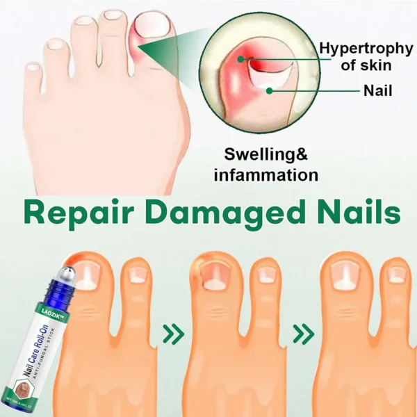 LAOZIK™  Nail Care Roll-On - Image 5