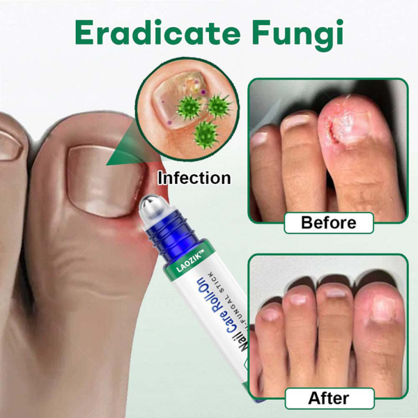 LAOZIK™  Nail Care Roll-On - Image 4