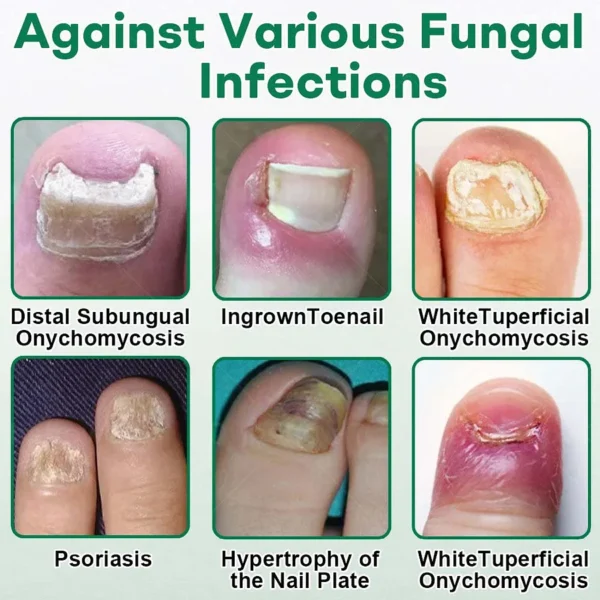 LAOZIK™  Nail Care Roll-On - Image 3