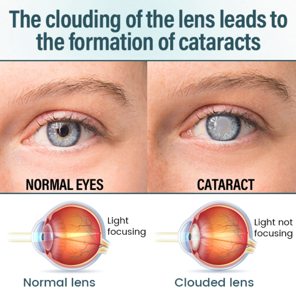 LAOZIK™ OptiFusion Nano Eye Drops Serum - Image 3