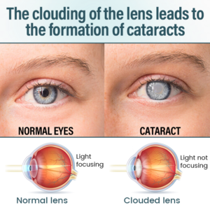 Alternative view of LAOZIK™ VisionFuse Nano Eye Drops Serum
