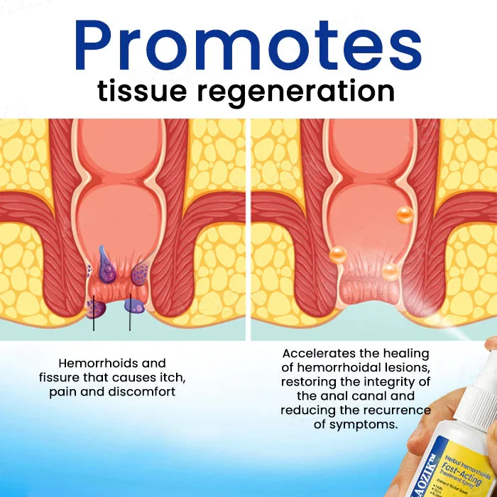LAOZIK™ Herbal Hemorrhoids Fast-Acting Treatment Spray - Image 3