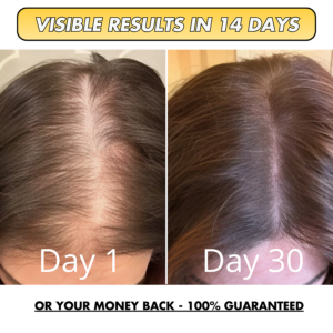 Alternative view of LAOZIK™ Natural Hair Boost