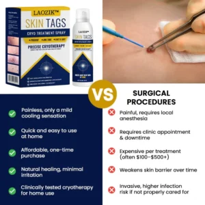 Alternative view of LAOZIK™ Skin Tag Cryo Treatment Spray
