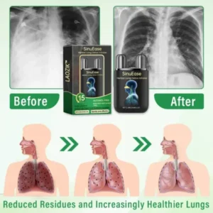 LAOZIK™ SinuEase Herbal Lung Detox Inhaler