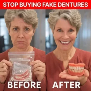 Alternative view of LAOZIK™ Custom-Fit Functional Dentures