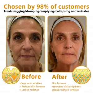 Alternative view of LAOZIK™ Bee Poison Skin Restoration Cream
