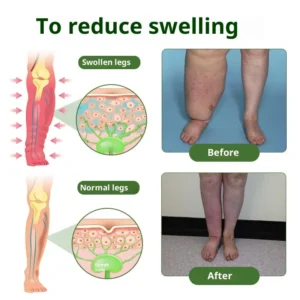 Alternative view of Laozik® Professional Foot Cream
