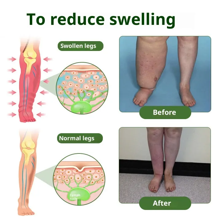 Laozik® Professional Foot Cream - Image 2