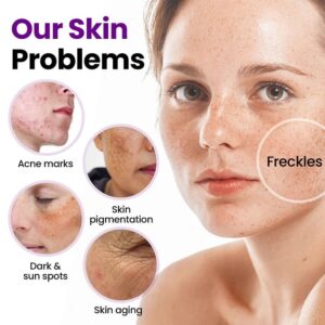 Alternative view of Laozik® StainFade Facial Serum with Probiotics