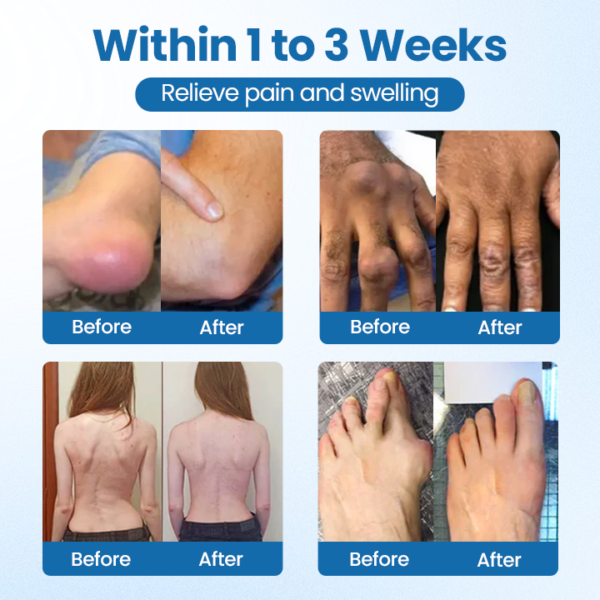 LAOZIK™ BPC-157 Joint Repair Cream